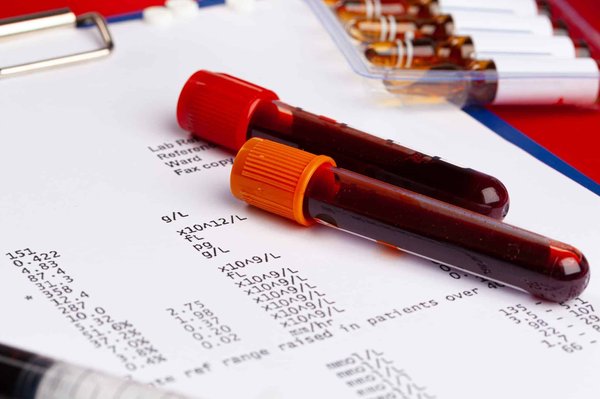 Pourquoi le voyant Anti-pollution ?